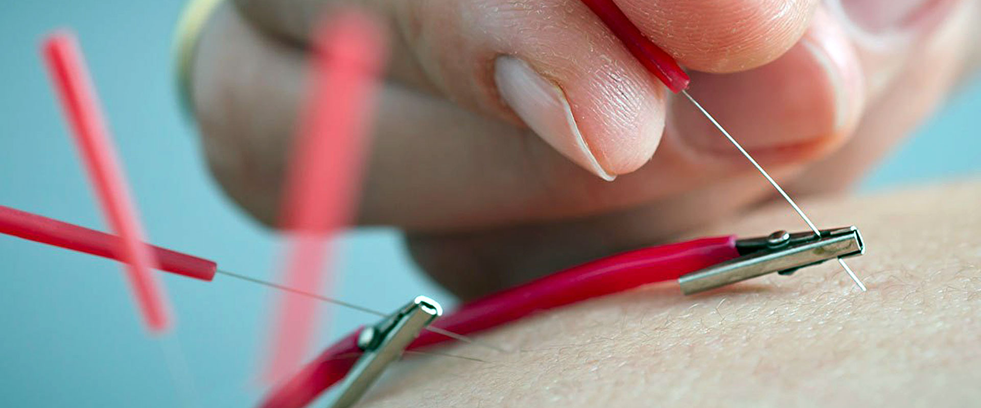 electro dry needling electro dry needling